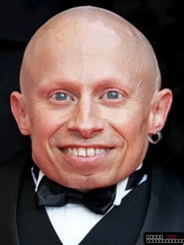 Verne Troyer